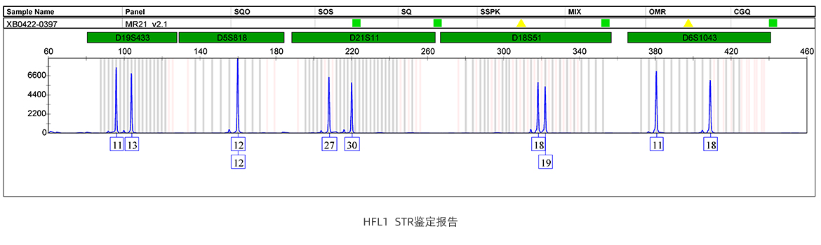 HFL1  STR鑒定報(bào)告