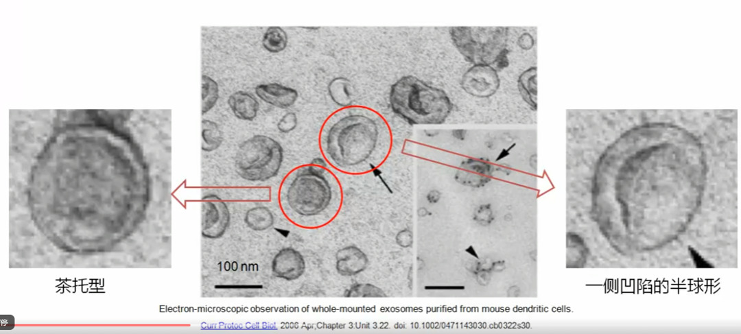 電鏡下的外泌體結(jié)構(gòu)