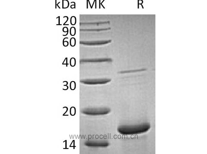 Procell-FGF-1/ FGFa/ FGF-acidic (Ala2-Asp155), Human, Recombinant