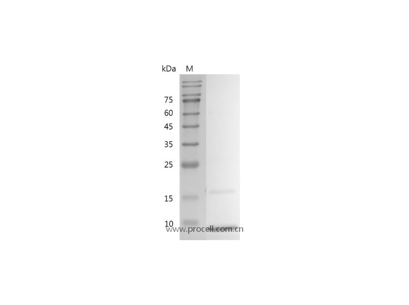 IGF-I/Somatamedin C/IGF-IA, Human, Recombinant