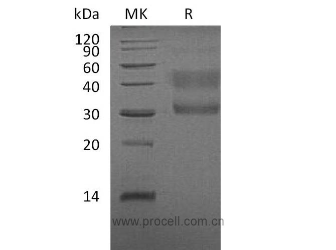 Procell-HGF R/ c-Met/ HGFR, Human, Recombinant