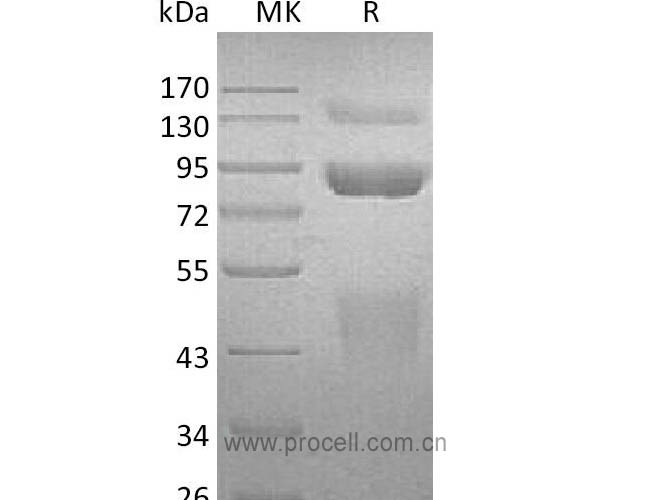 HGF R/ c-Met/ HGFR, Human, Recombinant