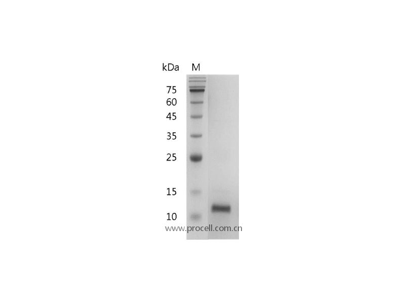 IL-4/BSF-1, Human, Recombinant