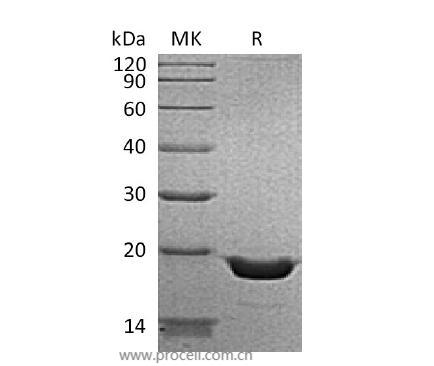 Procell-TNF-α/ TNFA/ TNFSF2 (N-6His), Human, Recombinant