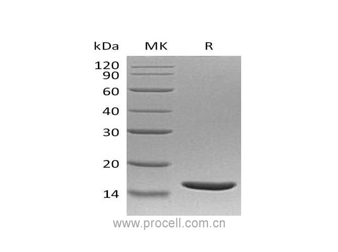 TNF-β/ TNFB/ TNFSF1, Human, Recombinant