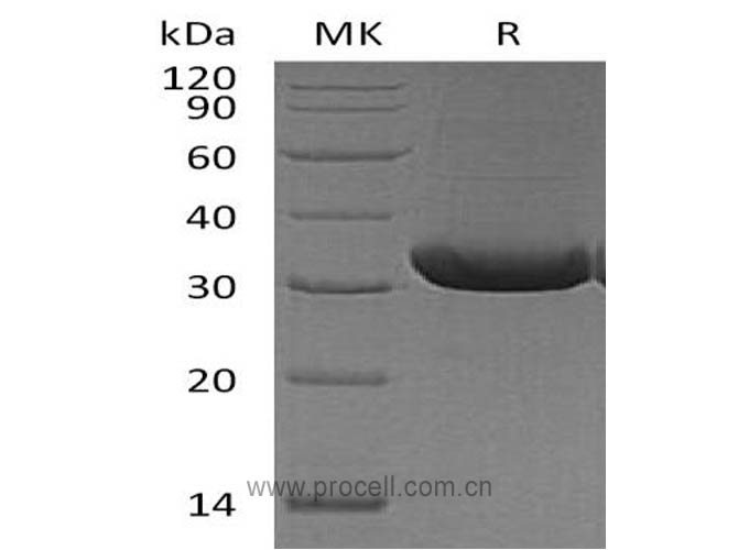 Procell-RANK L/ TRANCE/ TNFSF11 (C-6His), Mouse, Recombinant