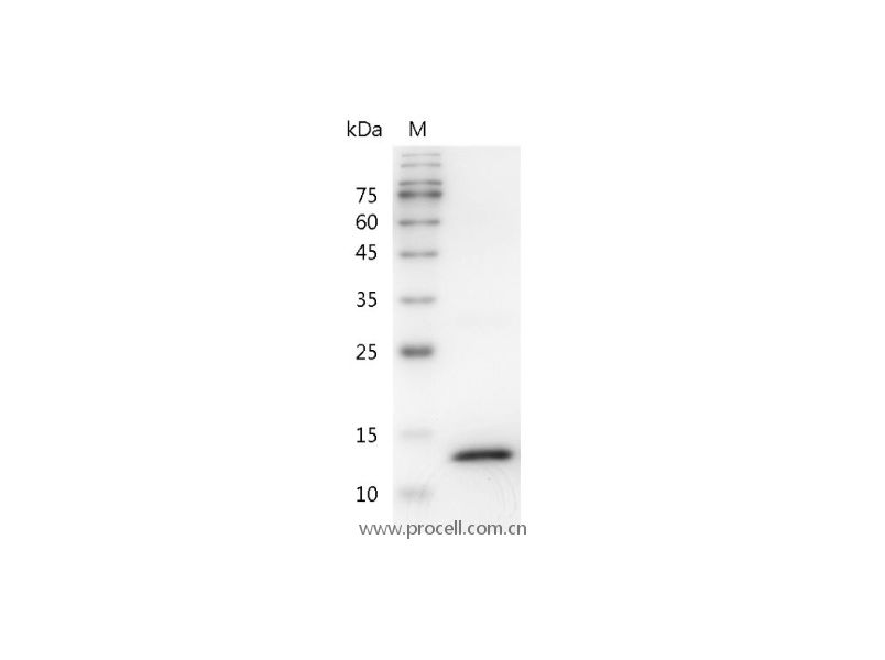 Interferon γ/IFN-γ/IFNG, Mouse, Recombinant