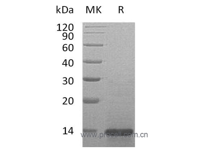 β-NGF/ NGF/ NGFB (Ser122-Gly241), Mouse, Recombinant (暫不出售)