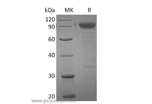 IL-3RA, Human, Recombinant