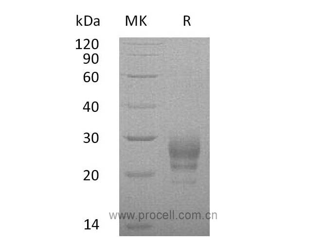 IL-7 (C-6His), Human, Recombinant