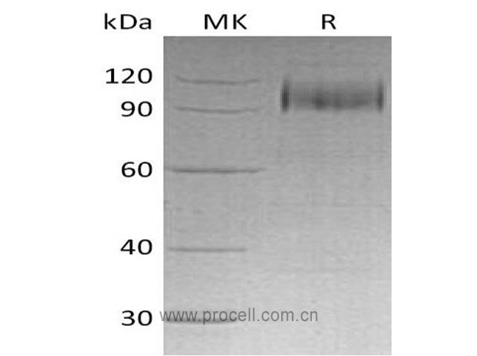 EGFR/ ErbB1/ HER1 (C-6His), Human, Recombinant