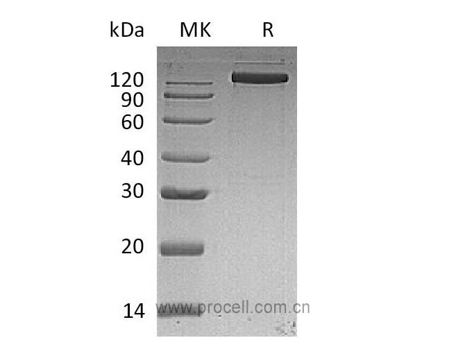 Procell-EGFR/ ErbB1/ HER1 (C-Fc), Human, Recombinant