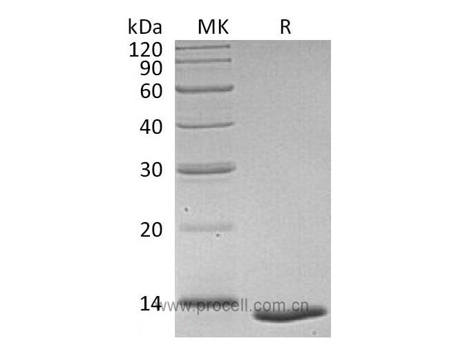 Procell-TGFB1/ TGFβ1/ TGF-β1, Human, Recombinant