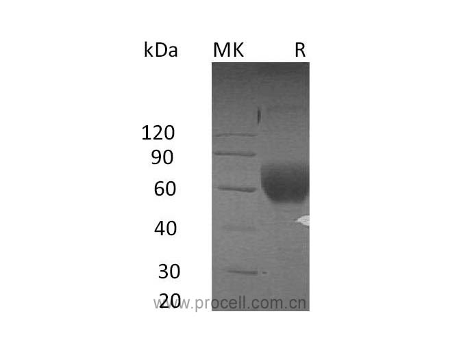 TGFβR2/ TGFBR2, Human, Recombinant