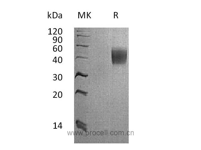 IL-4Ra (C-6His), Cynomolgus, Recombinant