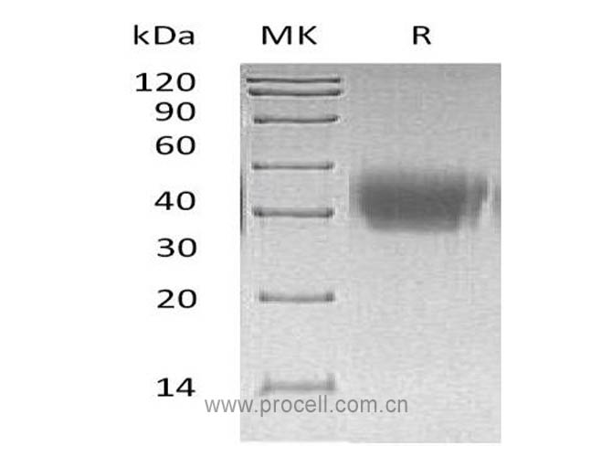 ACVR2A (C-6His), Human, Recombinant