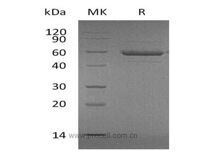 Procell-APRIL/ TNFSF13/ TRDL-1α (N-Flag-His), Human, Recombinant