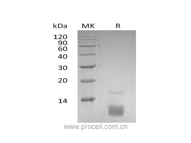 RANTES/ CCL5, Human, Recombinant