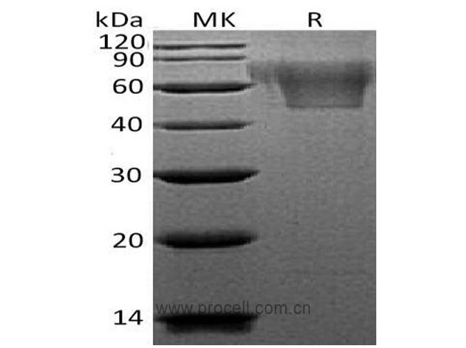 Fractalkine/ CX3CL1 (C-6His), Human, Recombinant