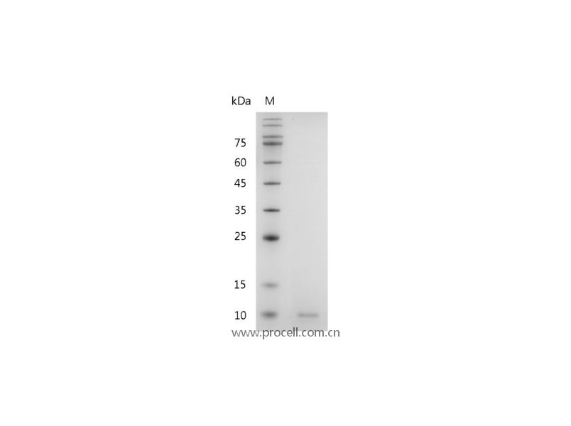 CXCL5/ENA-78, Human, Recombinant