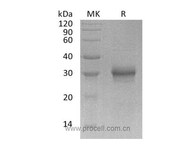 FGF-17 (C-6His), Human, Recombinant