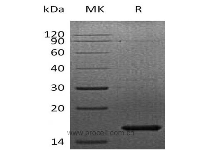 FGF-7/ KGF, Human, Recombinant