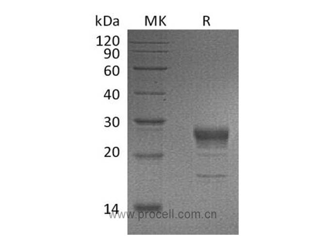 FGF-7/ KGF (C-6His), Human, Recombinant