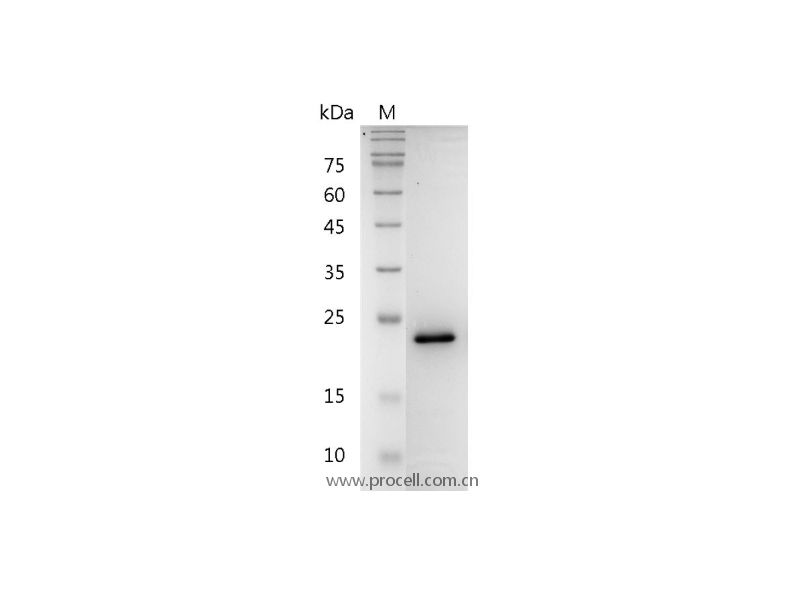 FGF-8a/AIGF/HBGF-8, Human, Recombinant