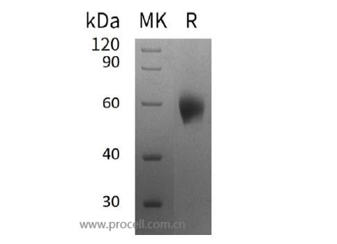 IL-1RAcP/ IL-1R3/ IL-1F6 (C-6His), Human, Recombinant