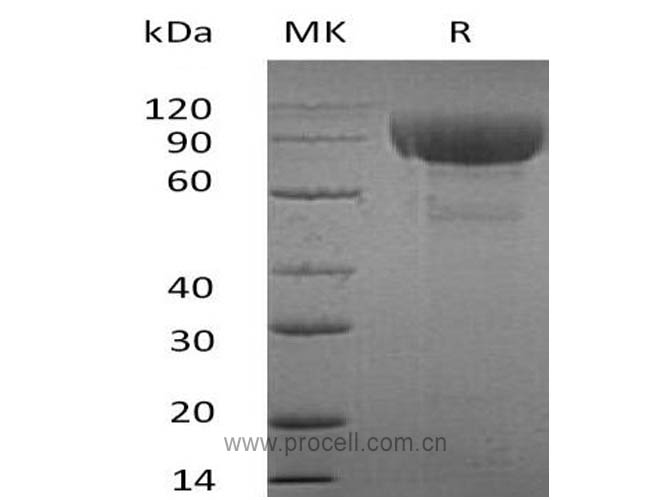 Procell-IL-1RL2 (C-Fc), Human, Recombinant