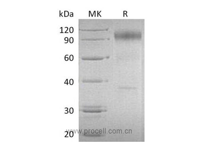 IL-23R (C-Fc), Human, Recombinant