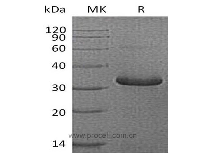 IGFBP1/ IBP-1 (C-6His), Human, Recombinant