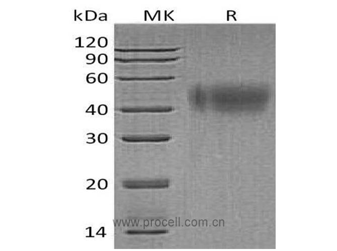 IFNAR2 (C-6His), Human, Recombinant