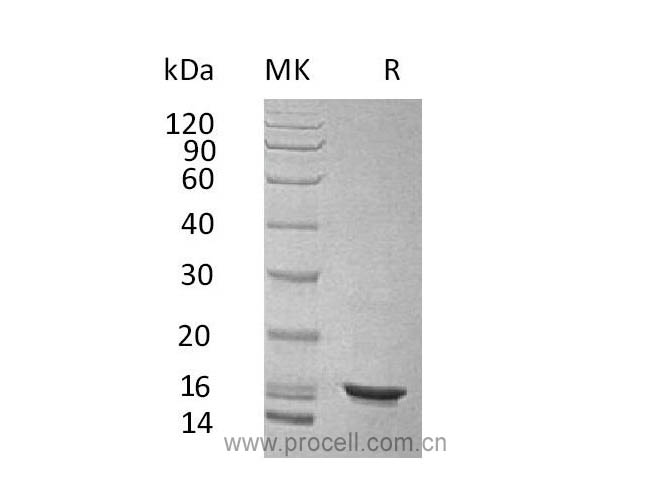 IL-10/ IL10A, Human, Recombinant