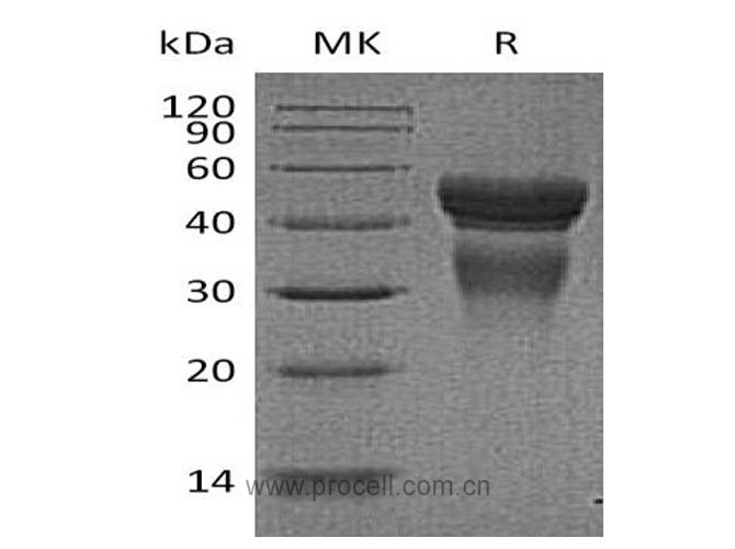 IL-12/ IL12A, Human, Recombinant