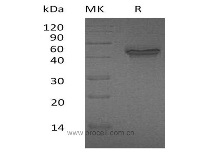 IL-12B/ IL-12 p40, Human, Recombinant