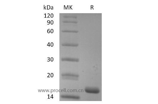 IL-18/ IL-1F4 (C-6His), Human, Recombinant