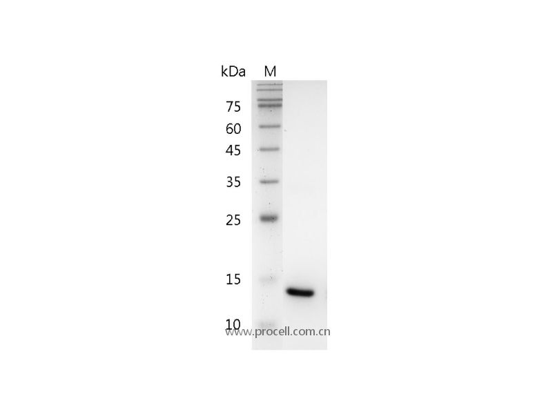 IL-22/IL-TIF, Human, Recombinant