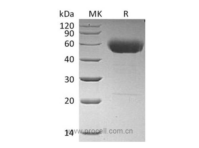 Procell-IL-22 (C-hIgG2 Fc), Human, Recombinant