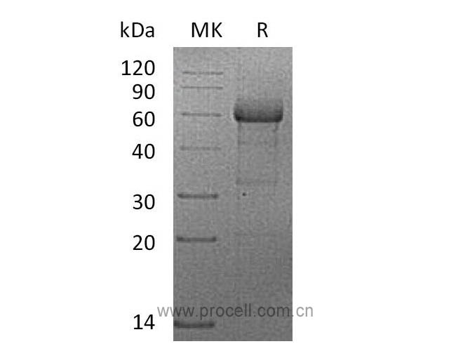 Procell-TNF-R2/ CD120b/ TNFRSF1B (C-mFc), Human, Recombinant