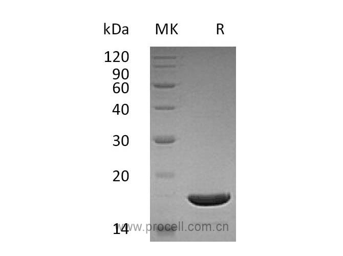 CD253/ TNFSF10/ TRAIL, Human, Recombinant