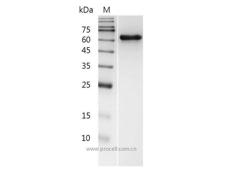 MMP2/Gelatinase A/TBE-1/MONA, Human, Recombinant