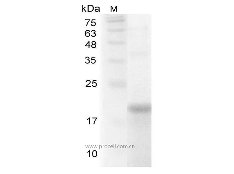 IL-32α/NK4/TAIF, Human, Recombinant