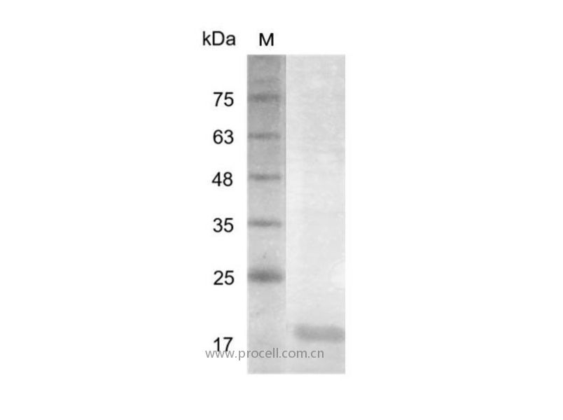 IL-23 p19/IL-23/IL-23A/SGRF, Human, Recombinant