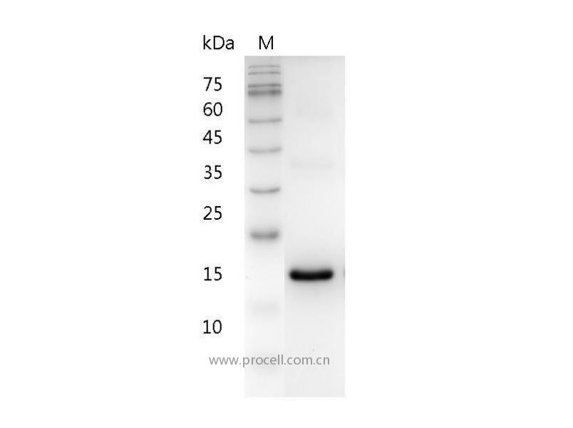 IFNω/IFN alpha II-1/IFNW1, Human, Recombinant