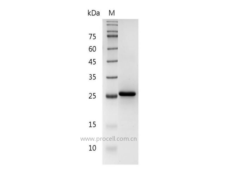 IL-34/C16orf77, Human, Recombinant