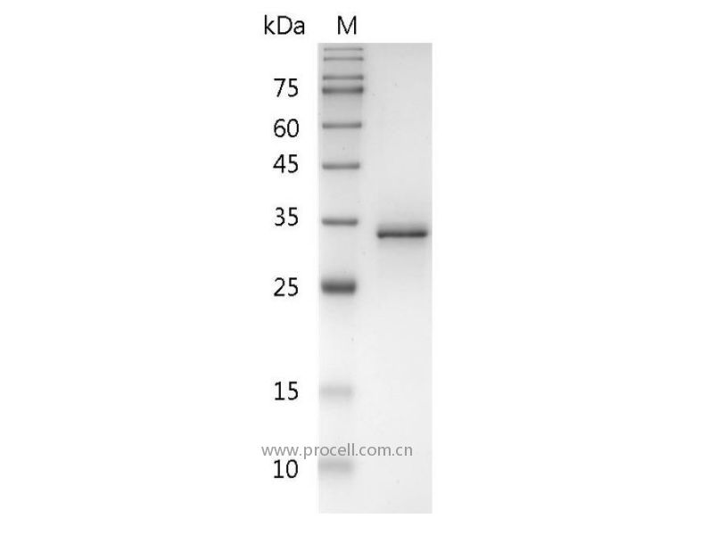 FasL/TNFSF6/CD95L/CD178, Human, Recombinant