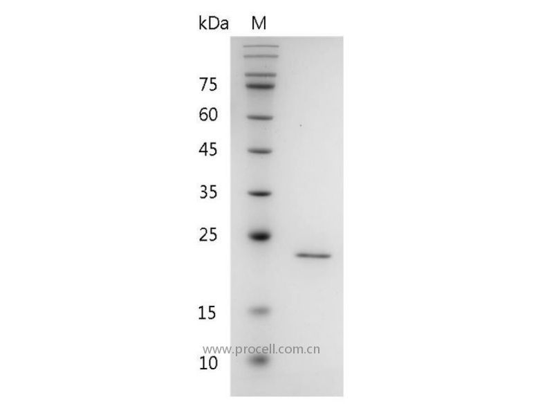 FGF-3/HBGF-3/INT2, Human, Recombinant