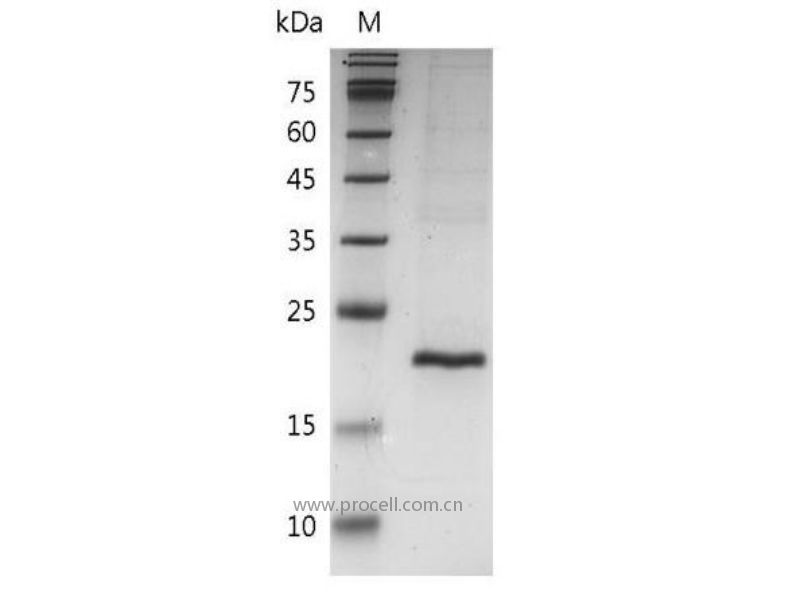 TNF-β/TNFB/ TNFSF1, Mouse, Recombinant