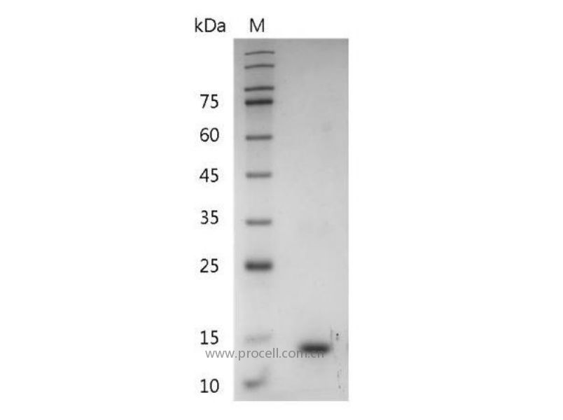 IL-31, Mouse, Recombinant